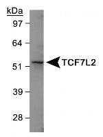 TCF7L2 Antibody in Western Blot (WB)