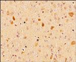 LC3A Antibody in Immunohistochemistry (Paraffin) (IHC (P))