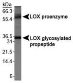 LOX Antibody in Western Blot (WB)