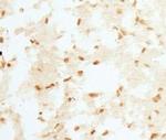 RCAN1 Antibody in Immunohistochemistry (Paraffin) (IHC (P))