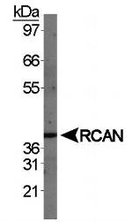 RCAN1 Antibody in Western Blot (WB)