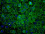 PKM2 Antibody in Immunocytochemistry (ICC/IF)