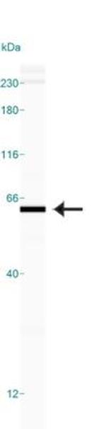 PKM2 Antibody in Western Blot (WB)