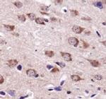 USP9X Antibody in Immunohistochemistry (Paraffin) (IHC (P))