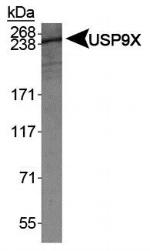 USP9X Antibody in Western Blot (WB)