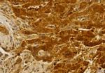 CCR2 Antibody in Immunohistochemistry (Paraffin) (IHC (P))