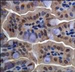 RBBP6 Antibody in Immunohistochemistry (Paraffin) (IHC (P))