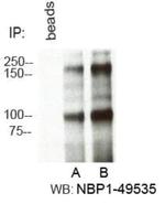 RBBP6 Antibody in Immunoprecipitation (IP)