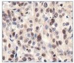 SIRT1 Antibody in Immunohistochemistry (Paraffin) (IHC (P))