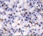 JMJD2C Antibody in Immunohistochemistry (Paraffin) (IHC (P))