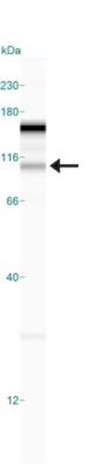 JMJD2C Antibody in Western Blot (WB)