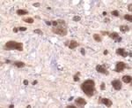 JMJD1A Antibody in Immunohistochemistry (Paraffin) (IHC (P))