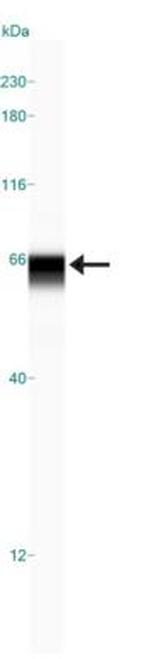 USP22 Antibody in Western Blot (WB)