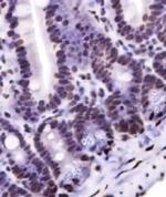 Nkx6.1 Antibody in Immunohistochemistry (Paraffin) (IHC (P))