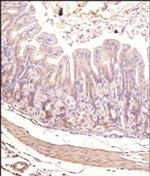 TEK Antibody in Immunohistochemistry (Paraffin) (IHC (P))