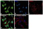 PTCH Antibody in Immunocytochemistry (ICC/IF)