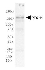 PTCH Antibody in Western Blot (WB)