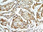 AGR2 Antibody in Immunohistochemistry (Paraffin) (IHC (P))