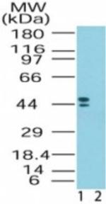 CRHR2 Antibody in Western Blot (WB)