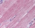 RAB7 Antibody in Immunohistochemistry (Paraffin) (IHC (P))