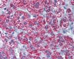 CYP1B1 Antibody in Immunohistochemistry (Paraffin) (IHC (P))