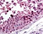 ROR gamma Antibody in Immunohistochemistry (Paraffin) (IHC (P))