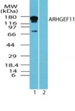 ARHGEF11 Antibody in Western Blot (WB)