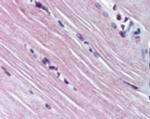 AMPD1 Antibody in Immunohistochemistry (Paraffin) (IHC (P))