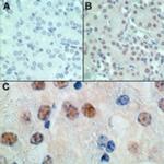 MSX1 Antibody in Immunohistochemistry (Paraffin) (IHC (P))