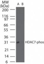 Phospho-HDAC7 (Ser155) Antibody in Western Blot (WB)