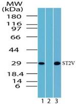 ST2 Antibody in Western Blot (WB)