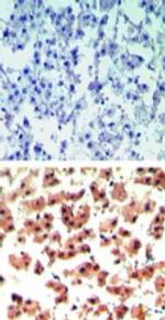 RGS19 Antibody in Immunohistochemistry (Paraffin) (IHC (P))