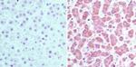 CRABP2 Antibody in Immunohistochemistry (Paraffin) (IHC (P))