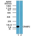 CRABP2 Antibody in Western Blot (WB)