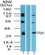 EDG6 Antibody in Western Blot (WB)