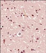 FMN2 Antibody in Immunohistochemistry (Paraffin) (IHC (P))