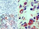 BMI-1 Antibody in Immunohistochemistry (Paraffin) (IHC (P))