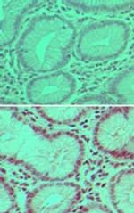 USP7 Antibody in Immunohistochemistry (Paraffin) (IHC (P))