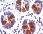 REG3A Antibody in Immunohistochemistry (Paraffin) (IHC (P))