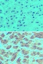 NALP11 Antibody in Immunohistochemistry (Paraffin) (IHC (P))