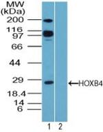 HOXB4 Antibody in Western Blot (WB)