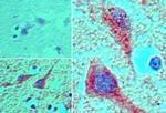 MEIS1 Antibody in Immunohistochemistry (Paraffin) (IHC (P))