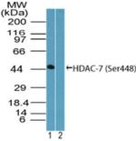 Phospho-HDAC7 (Ser448) Antibody in Western Blot (WB)