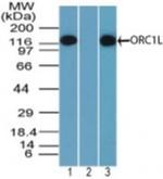 ORC1 Antibody in Western Blot (WB)