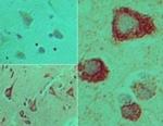 TICAM2 Antibody in Immunohistochemistry (Paraffin) (IHC (P))