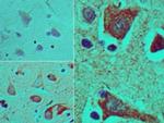 Brachyury Antibody in Immunohistochemistry (Paraffin) (IHC (P))