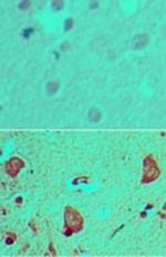 GLI1 Antibody in Immunohistochemistry (Paraffin) (IHC (P))