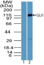 GLI1 Antibody in Western Blot (WB)