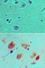 DLL3 Antibody in Immunohistochemistry (Paraffin) (IHC (P))