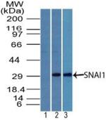 SNAIL Antibody in Western Blot (WB)